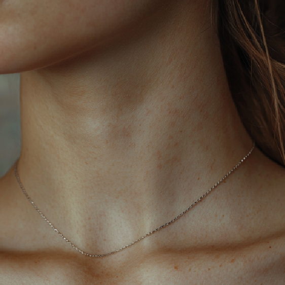 Vrásky na krk: Proč se stávají a jak se jich zbavit